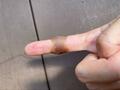 「あっ！ 危ない！」子どもがケガするその前に「備えておきたい」キャンプの安全対策と「応急治療の豆知識」の画像001