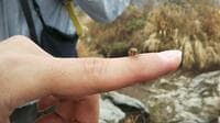 秋の2大「イヤな虫」対策「スズメバチ」かわし方＆「蚊の標的」アルコールNG！【被害ライター実体験レポ】