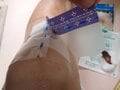 「アウトドアで怪我をしたら……」 山のガイドが教える応急処置！ 便利なモイストヒーリングパッドを活用！ 即試せる工夫も紹介の画像007