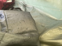 秋冬「びしょ濡れテントの季節」がやってきた！  寒さより厄介「雨ですか？」レベルの無残な室内… 晴れの日こそ大敵「結露」実態とは